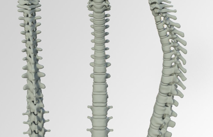 What Are Your Treatment Options For Spinal Tumors?