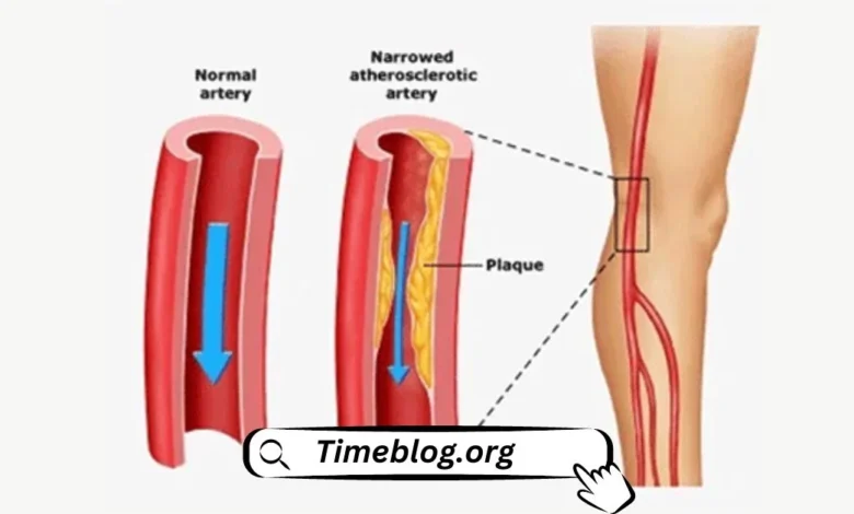 Peripheral Vascular